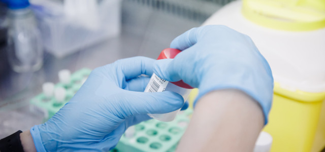 Eine Krankenschwester führt im Krankenhaus Ramon y Cajal in Madrid einen PCR-Test zur Erkennung des Affenpockenvirus durch.