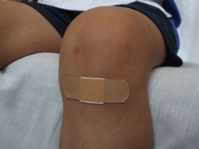In larger wounds, a patch may not be sufficient to stop bleeding.