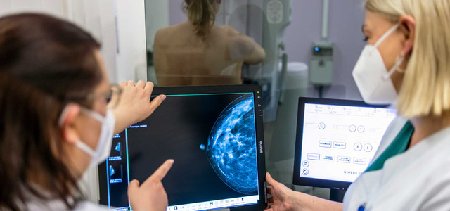 Mehr Nutzen als Risiken: Bundesamt empfiehlt Brustkrebs-Screening ab 45
