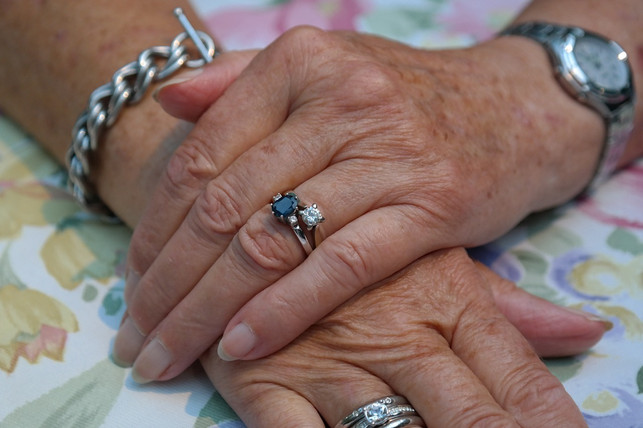 longitudinal grooves-in-the-fingernails-are-often-just-a-ha-cc0-pixabay-hans-190830_download Longitudinal grooves in the fingernails are often just a harmless sign that the body is aging.
