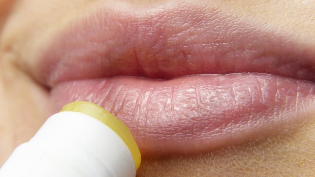 sonnenbrand-lippen-cc0-pixabay-silviarita-230721 sonnenbrand lippen