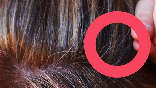 graue-haare-cc0-public-domain-pixabay-180423 Graue Haare