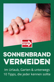 sonnebrand-vermeiden-w-190523 Sonnenbrand vermeiden: 10 Tipps, die jeder kennen sollte