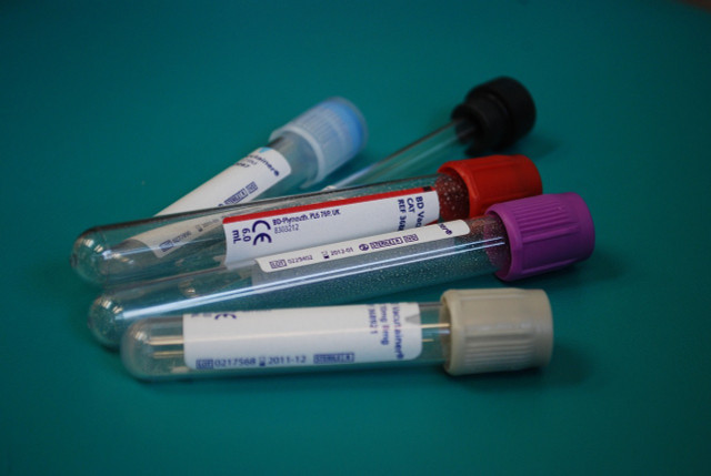Test blood levels for mineral deficiencies.
