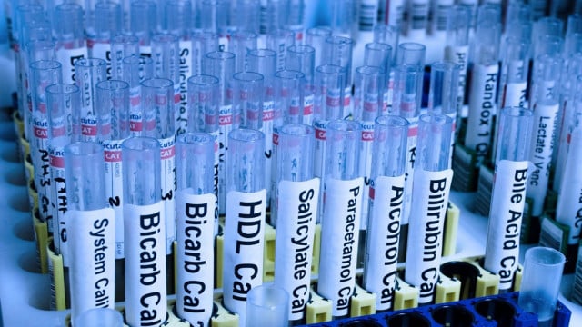 salicylsaeure-cc0-pixabay-publicdomainpictures-190820 salicylsäure