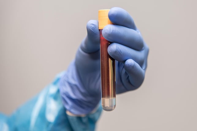 When donating blood, you cannot infect yourself with diseases.