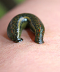 blutegel-waehrend-der-blutegeltherapie-cc0-pixabay-ellwi-200305_download Blutegel während der Blutegeltherapie.