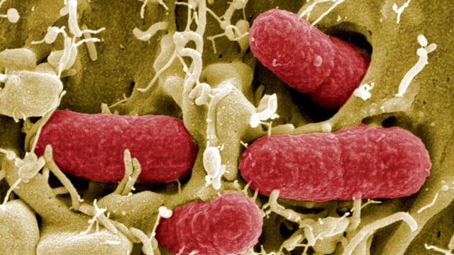 ehe-dpa Häufung von Ehec-Infektionen - wie gefährlich ist das?