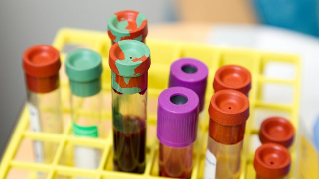 wv-spendeblut-us-national-cancer-institute-080621-1280x720-3 TK Weltverbesserer Blut spenden