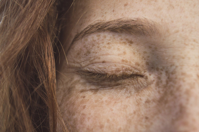 Mostly and thorn-through muscles-U-CC0-Pixabay -chermioveove-25226_Download Most of the eyes are caused by muscles, which are also used when blinking.