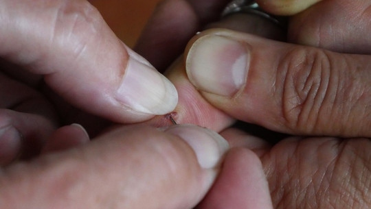 splitter-entfernen-cc0-pixabay-monikap-180804 Splitter entfernen