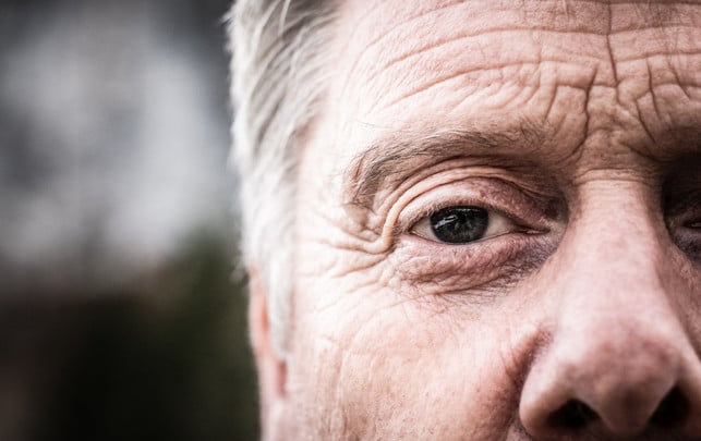 Sonnenebrand in the eye is created in a similar way to the skin.