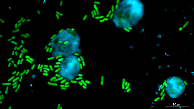 Nach „John Wick“-Star Keanu Reeves benannter Stoff könnte Medizin und Landwirtschaft helfen Keanumycin John Wick Keanu Reeves