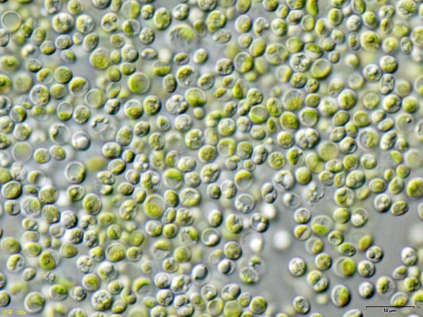 chlorella_vulgaris_nies2170_600 Chlorella