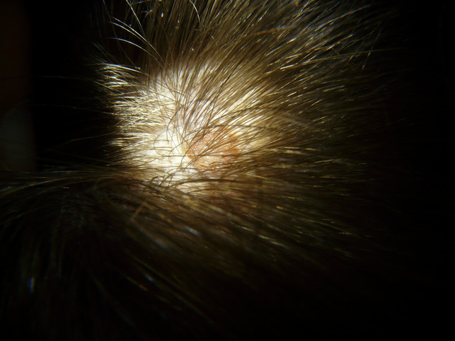 The scalp of humans is also often affected by cat fungus.
