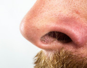 pickel in der nase