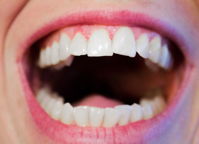one-Gute-mouth hygiene-flexible-talent-on-cc0-pixabay-kjertin_michaela-130329_download Good oral hygiene prevents bad breath.