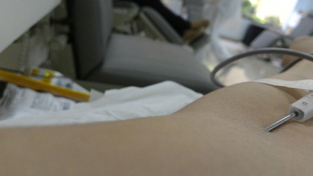 die-periphere-stamzellen-spende-erfolgt-ueber-das-b-cc0-pixabay-sarahmarciano-190927_download Die periphere Stammzellen-Spende erfolgt über das Blut.